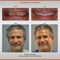Siranli Implants & Facial Aesthetics image 9
